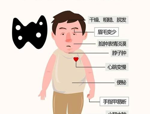 甲状腺机能低下症症状详解与全面解析