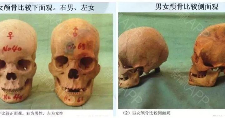 男女骨骼差异：从结构到功能的全面解析
