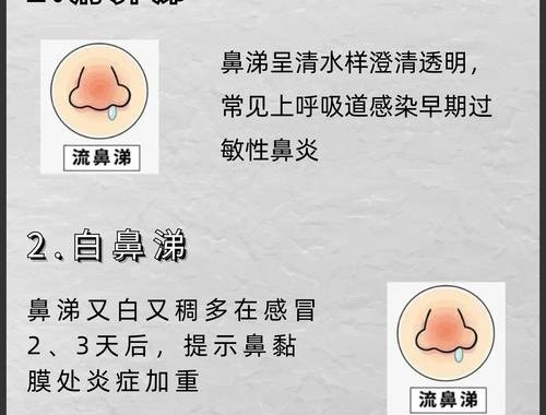 绿鼻涕是什么感冒？深入解析与应对措施